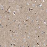 PALMD Antibody in Immunohistochemistry (IHC)