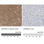 Coronin 2B Antibody in Immunohistochemistry (IHC)