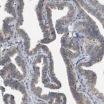Coronin 2B Antibody in Immunohistochemistry (IHC)
