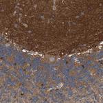 Coronin 2B Antibody in Immunohistochemistry (IHC)