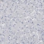Coronin 2B Antibody in Immunohistochemistry (IHC)