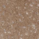 Coronin 2B Antibody in Immunohistochemistry (IHC)