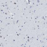 HLA-DPA1 Antibody in Immunohistochemistry (IHC)