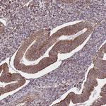 DCHS1 Antibody in Immunohistochemistry (Paraffin) (IHC (P))