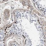 MAS1L Antibody in Immunohistochemistry (Paraffin) (IHC (P))