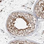 MFAP3L Polyclonal Antibody