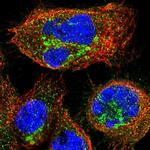 KIAA0430 Polyclonal Antibody