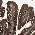 KIAA0430 Antibody in Immunohistochemistry (IHC)