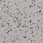 BCKDK Antibody in Immunohistochemistry (Paraffin) (IHC (P))