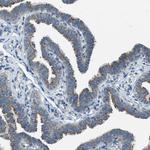 BCKDK Antibody in Immunohistochemistry (Paraffin) (IHC (P))