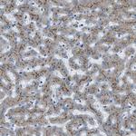 BCKDK Antibody in Immunohistochemistry (Paraffin) (IHC (P))