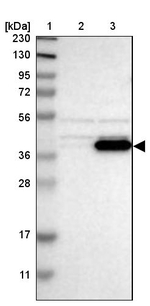 BCKDK Antibody in Western Blot (WB)