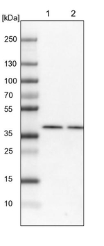 BCKDK Antibody in Western Blot (WB)