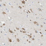 TUB Antibody in Immunohistochemistry (Paraffin) (IHC (P))