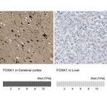 FOXK1 Antibody in Immunohistochemistry (IHC)