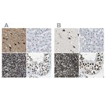 FOXK1 Antibody in Immunohistochemistry (IHC)