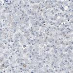 FOXK1 Antibody in Immunohistochemistry (IHC)