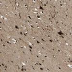 FOXK1 Antibody in Immunohistochemistry (IHC)