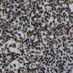 FOXK1 Antibody in Immunohistochemistry (IHC)