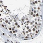 FOXK1 Antibody in Immunohistochemistry (IHC)