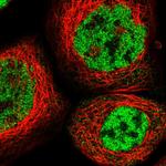 RBM5 Antibody in Immunocytochemistry (ICC/IF)