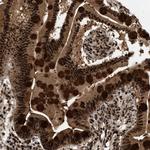 RBM5 Antibody in Immunohistochemistry (Paraffin) (IHC (P))