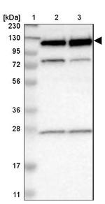 RBM5 Antibody in Western Blot (WB)