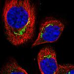 C10orf118 Polyclonal Antibody