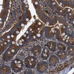 C10orf118 Antibody in Immunohistochemistry (Paraffin) (IHC (P))