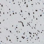 TTC13 Polyclonal Antibody