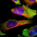 LYSMD3 Polyclonal Antibody