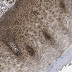 LYSMD3 Antibody in Immunohistochemistry (Paraffin) (IHC (P))