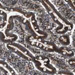 LYSMD3 Antibody in Immunohistochemistry (Paraffin) (IHC (P))