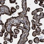 LYSMD3 Antibody in Immunohistochemistry (Paraffin) (IHC (P))