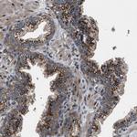 LYSMD3 Antibody in Immunohistochemistry (Paraffin) (IHC (P))