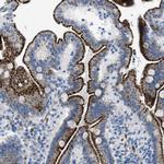 TMEM180 Antibody in Immunohistochemistry (Paraffin) (IHC (P))