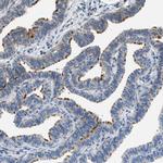 TMEM180 Antibody in Immunohistochemistry (Paraffin) (IHC (P))