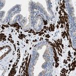 TMEM180 Antibody in Immunohistochemistry (Paraffin) (IHC (P))