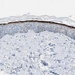 TMEM180 Antibody in Immunohistochemistry (Paraffin) (IHC (P))