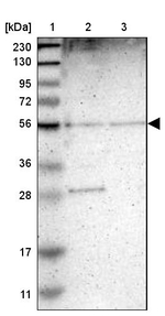 TMEM180 Antibody in Western Blot (WB)