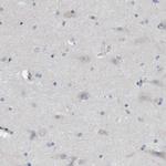 TMEM159 Antibody in Immunohistochemistry (Paraffin) (IHC (P))