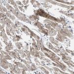 TMEM159 Polyclonal Antibody