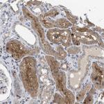 TMEM159 Antibody in Immunohistochemistry (Paraffin) (IHC (P))