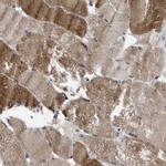 TMEM159 Antibody in Immunohistochemistry (Paraffin) (IHC (P))