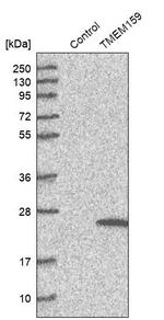 TMEM159 Antibody in Western Blot (WB)