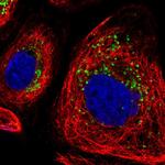 DRAM2 Antibody in Immunocytochemistry (ICC/IF)