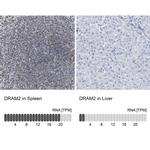 DRAM2 Antibody in Immunohistochemistry (IHC)