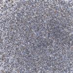 DRAM2 Antibody in Immunohistochemistry (IHC)