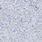 DRAM2 Antibody in Immunohistochemistry (IHC)
