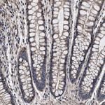 SQLE Antibody in Immunohistochemistry (Paraffin) (IHC (P))